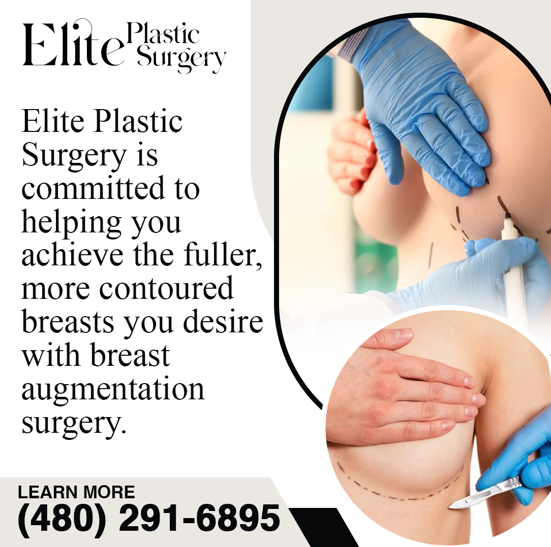 breast augmentation surgery